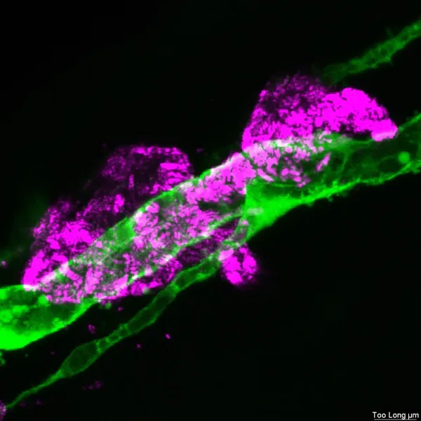 Vascular detail — Confocal · 63× zoom