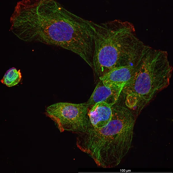 1 µm particles — Confocal · 40×
