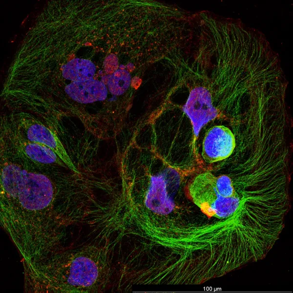 LPS — Confocal · 40× · LIGHTNING SVCC