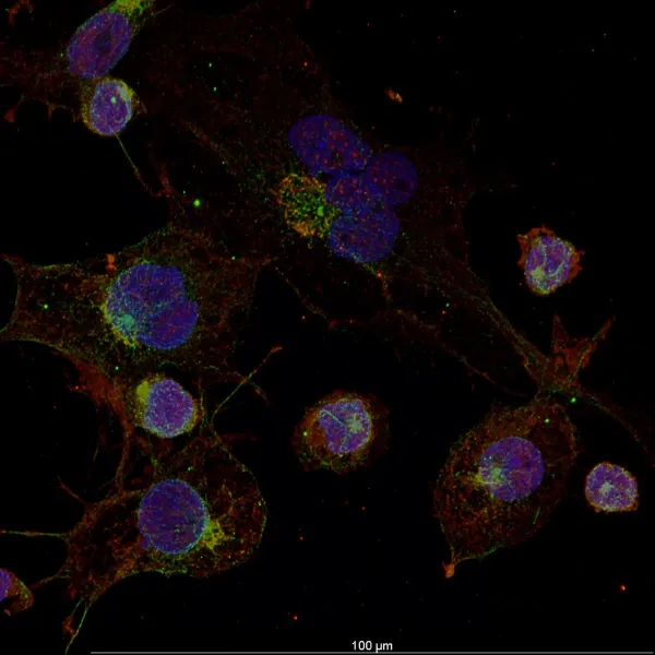 LPS — Confocal · LIGHTNING SVCC