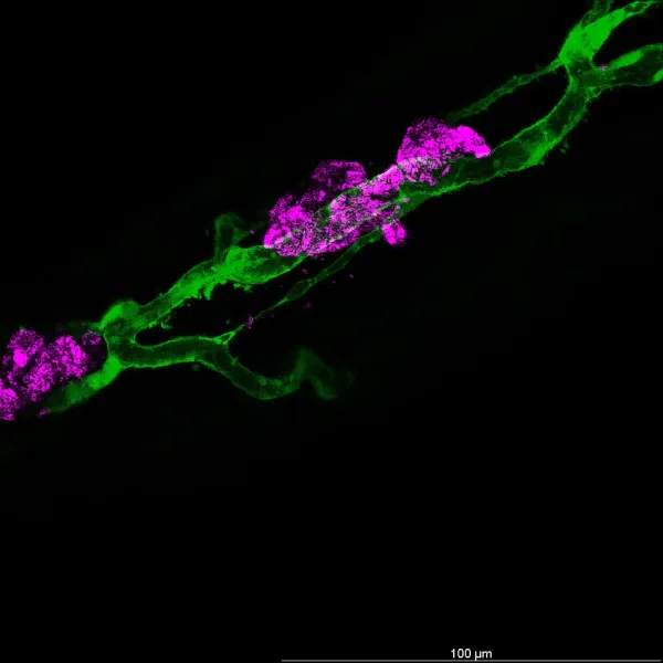 Vascular detail — Confocal · LIGHTNING SVCC