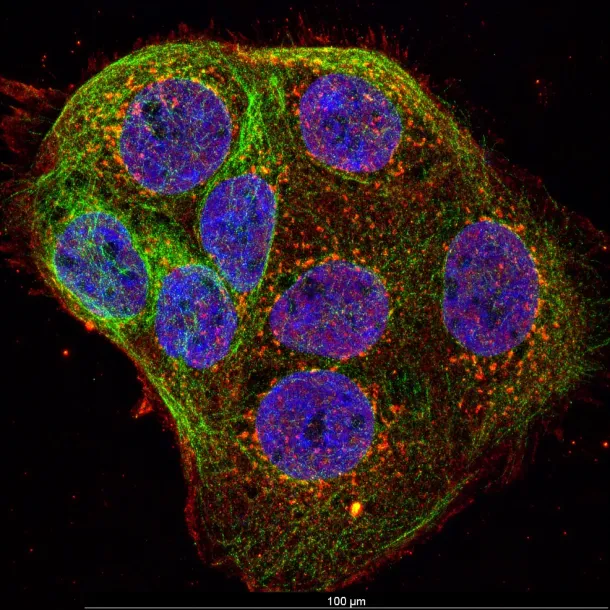Human cell model under confocal microscopy