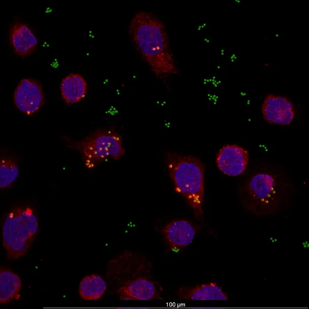 Cells with internalised plastic particles under confocal microscopy
