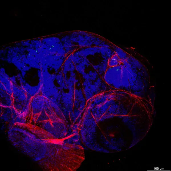 Larval imaging — Confocal · LIGHTNING LVCC