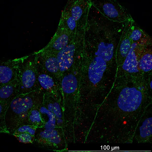 1 µm particles — Confocal · 40× · LIGHTNING SVCC