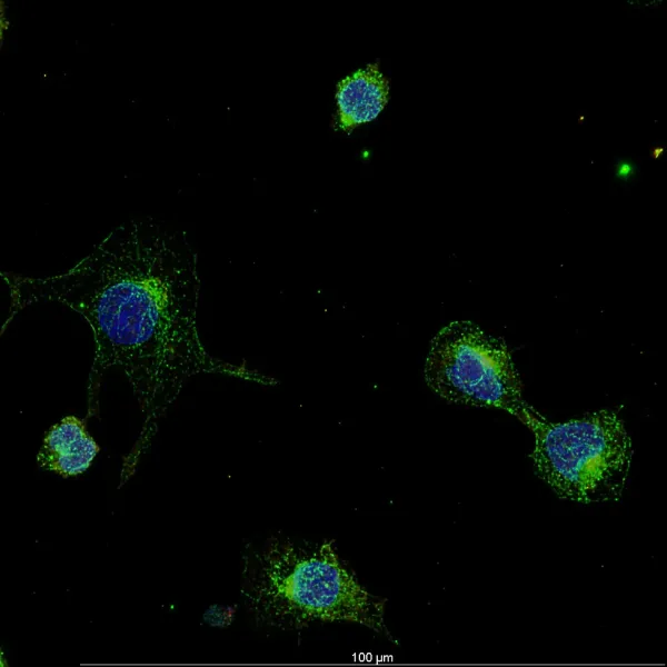 LPS + 1 µm particles — Confocal · LIGHTNING SVCC